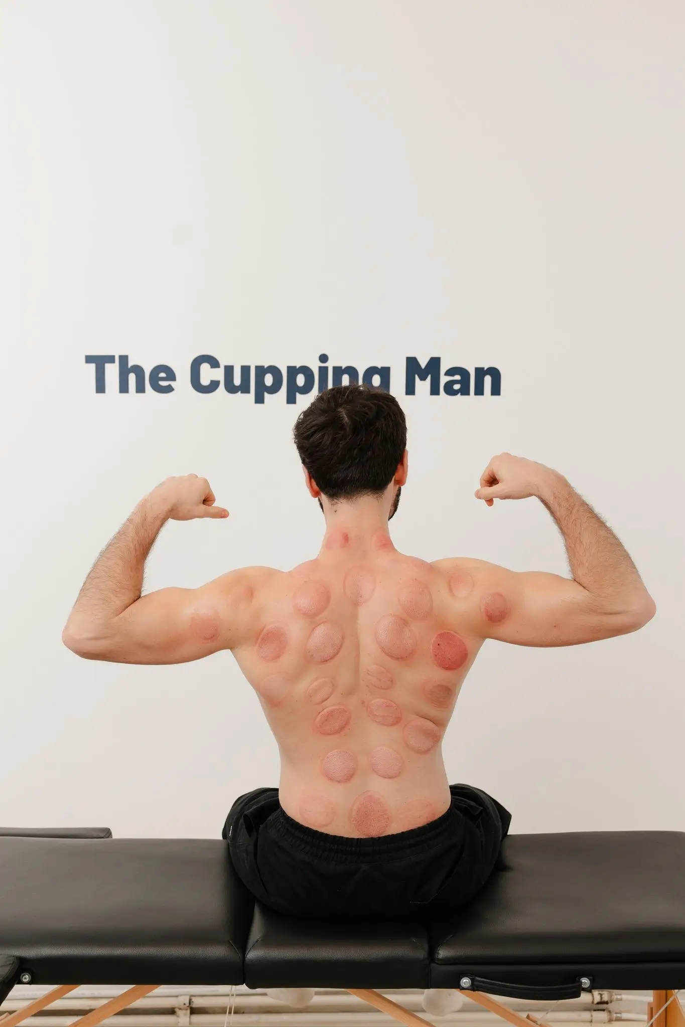The Cupping Man resultaat